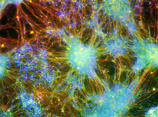 Conexão. Não há nome melhor para uma foto que mostra uma rede de neurônios humanos conectados. A imagem é de Alexandre Teixeira Vessoni Conexão. Não há nome melhor para uma foto que mostra uma rede de neurônios humanos conectados. A imagem é de Alexandre Teixeira Vessoni
