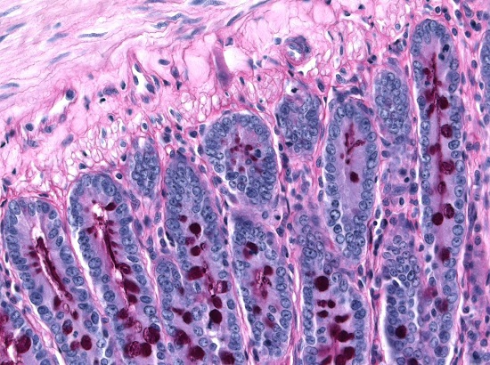O segundo lugar ficou com esta imagem, que mostra o glicogênio no intestino delgado de ratos.O autor é o pesquisador Marcos Vinícius Mendes Silva. O segundo lugar ficou com esta imagem, que mostra o glicogênio no intestino delgado de ratos.O autor é o pesquisador Marcos Vinícius Mendes Silva.