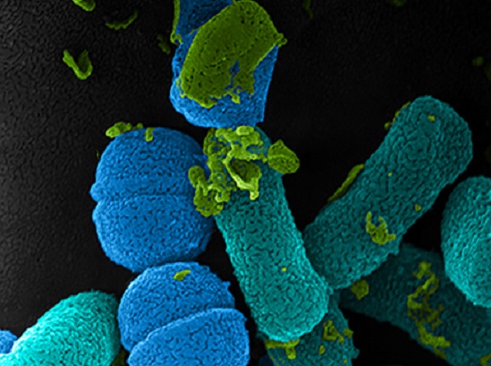 Nesta foto você vê bactérias da mucosa oral de um rato. O autor é Ii-sei Watanabe Nesta foto você vê bactérias da mucosa oral de um rato. O autor é Ii-sei Watanabe
