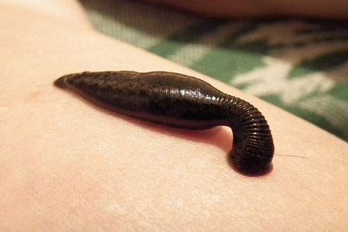 sanguessugas-sugando-sangue-leeches