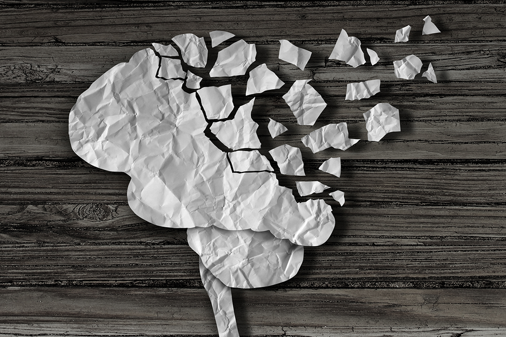 Esclerose múltipla aumenta risco de Alzheimer