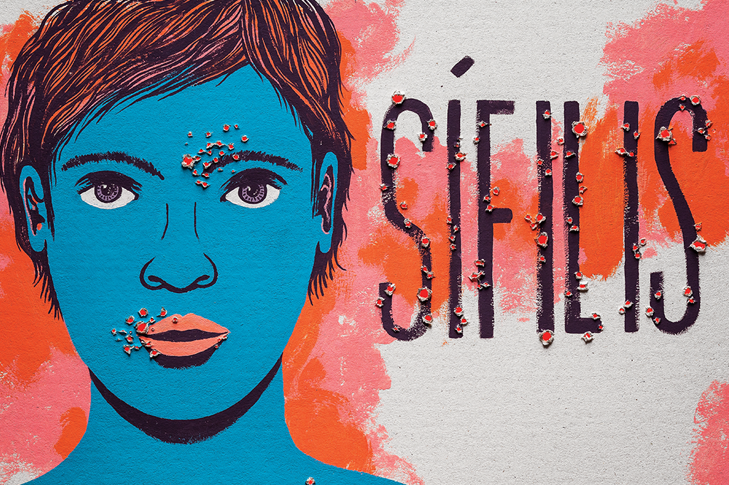 A nova cara da sífilis