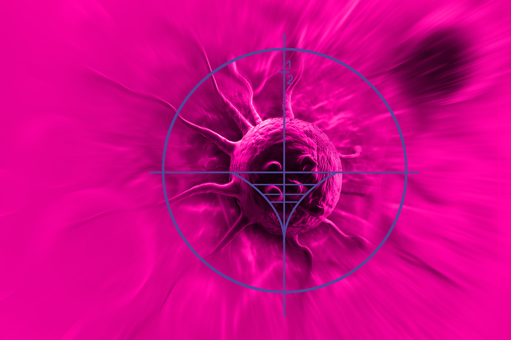 7 mitos sobre câncer e quimioterapia