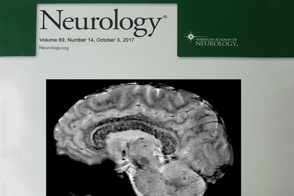 Brasileiros “fotografam” efeitos da altitude no cérebro e viram capa de revista científica