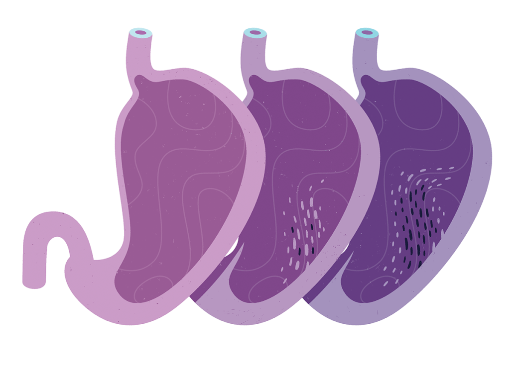 Medley_PubliHPylori_02