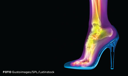 Usar salto alto faz mal?