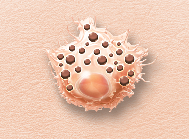 melanócito castanho