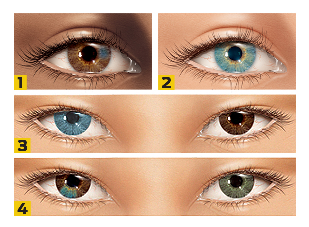heterocromia numerada heterocromia numerada