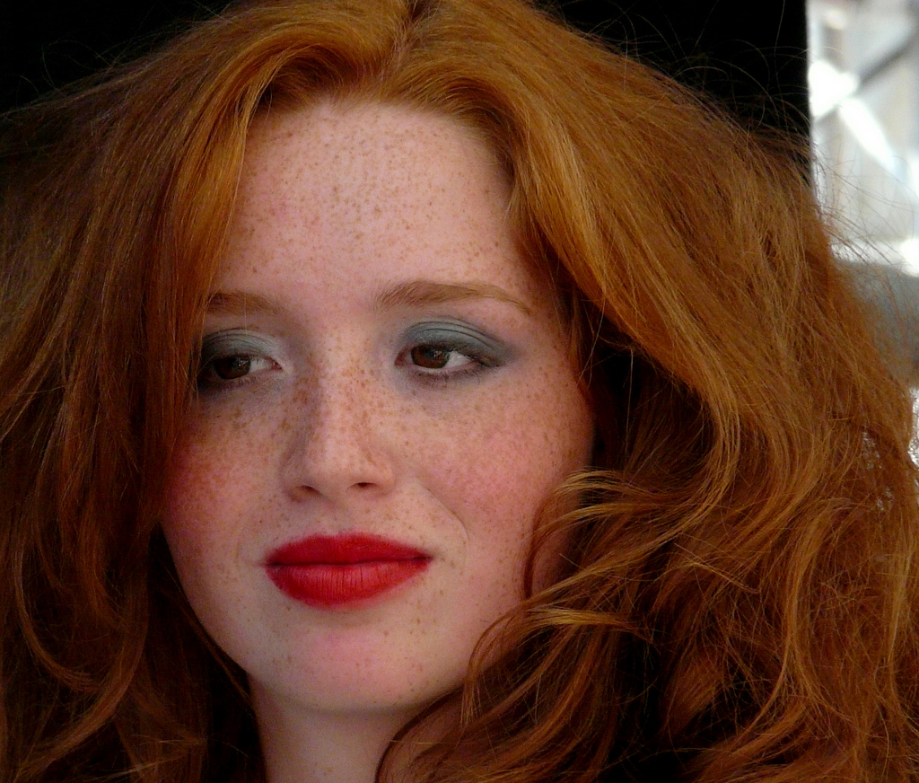 Por que todo ruivo tem sardas?