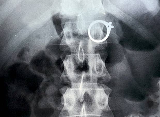 10 casos bizarros (e chocantes!) de crimes por dinheiro