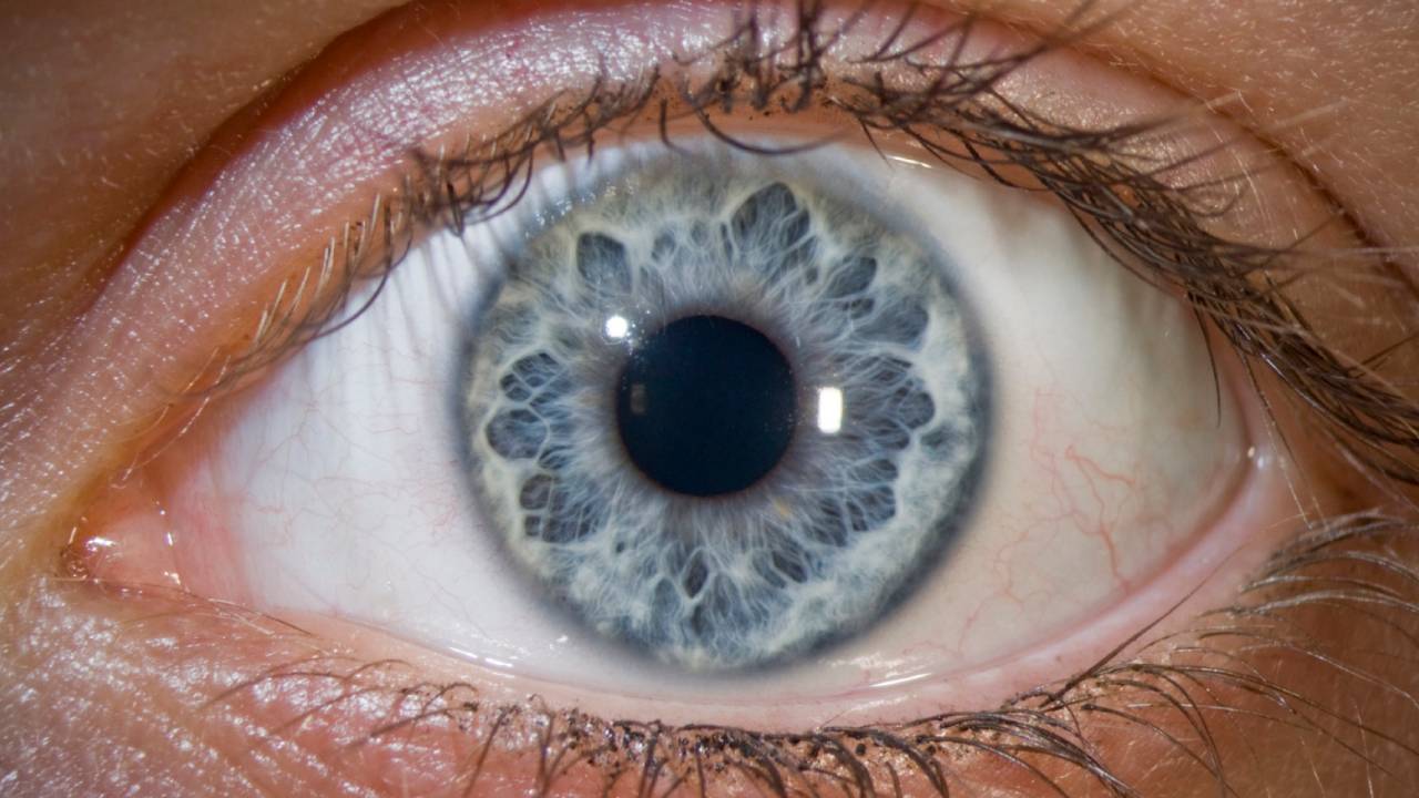 Olhos