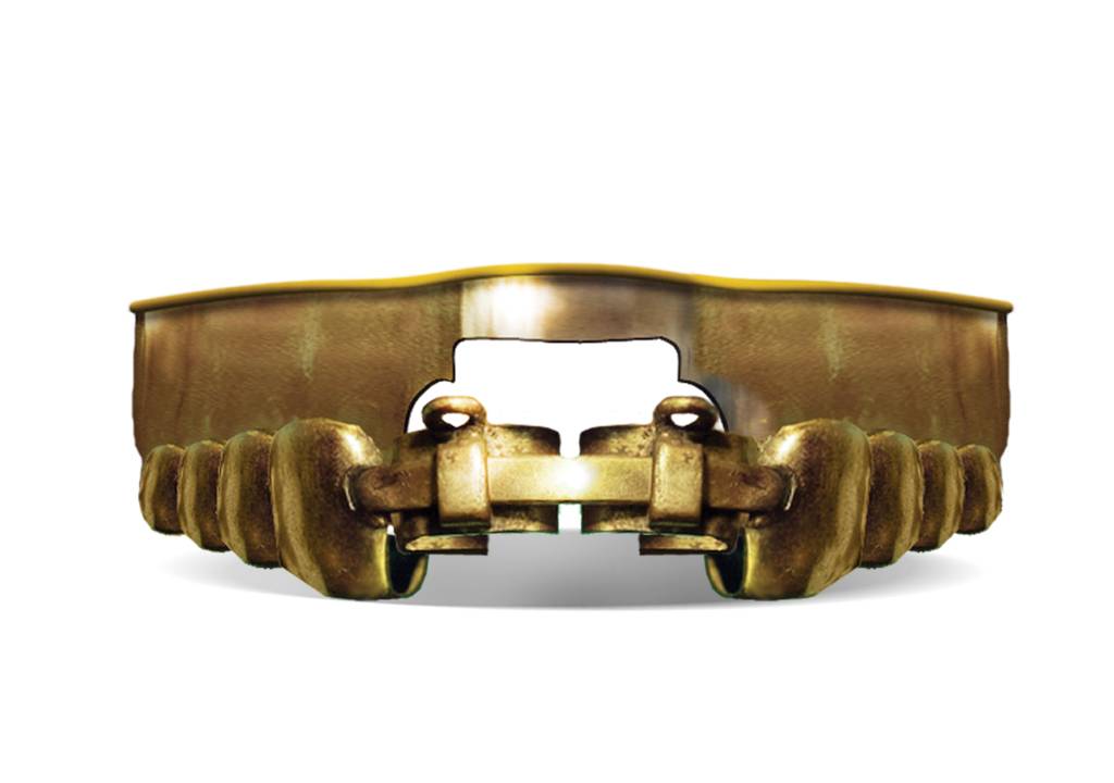 Aparelho ortodôntico bandeau