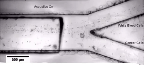 “Biópsia líquida” pode diagnosticar câncer sem dor