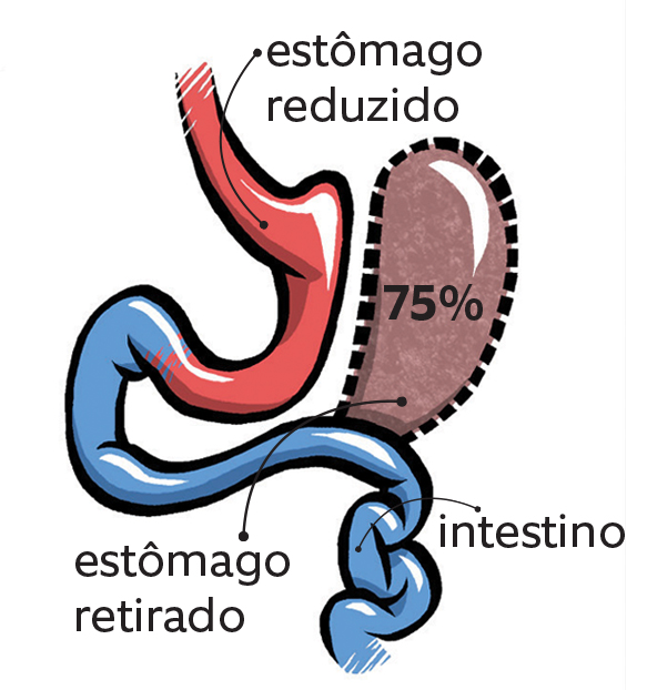 corte pela raiz