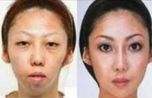 Chinês ganha indenização porque filha nasceu feia