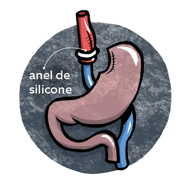 zoom anel silicone