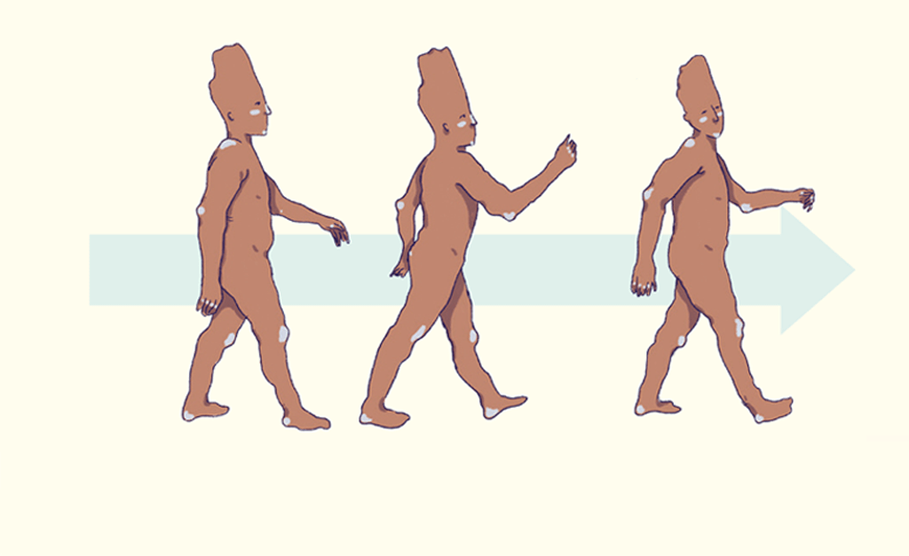 Por que balançamos os braços quando andamos?