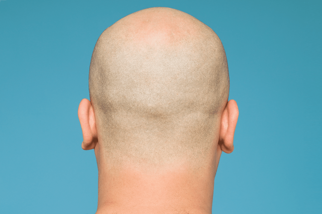 Por que temos de raspar o cabelo para entrar no Exército?