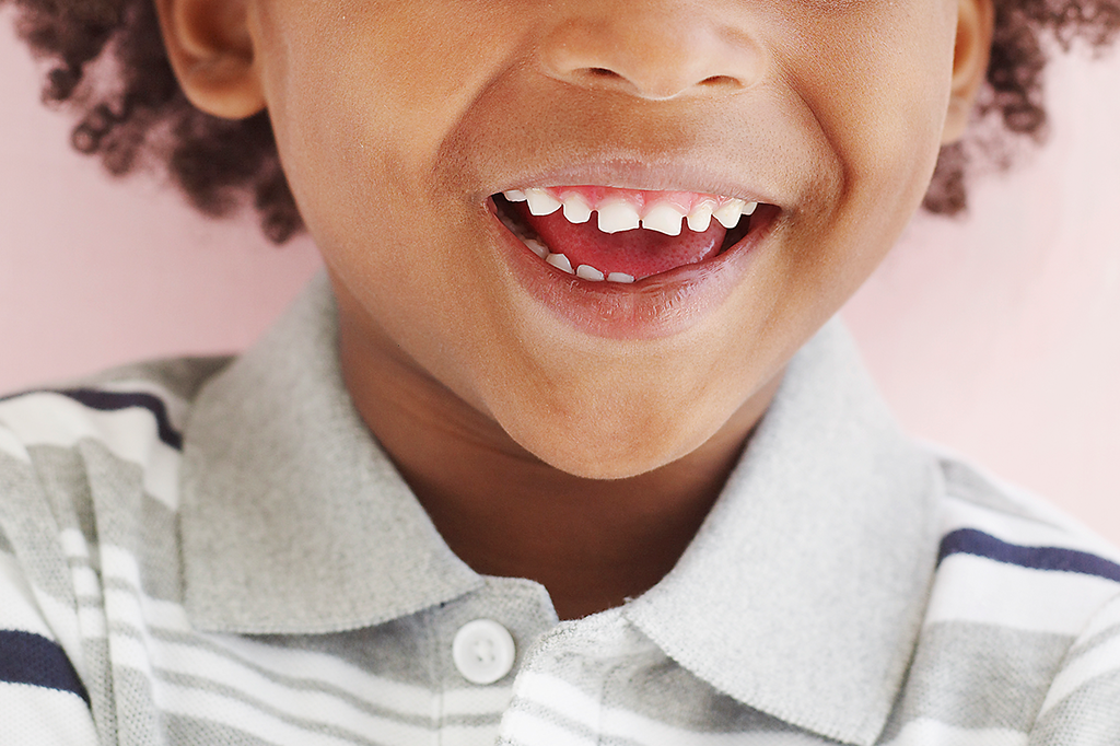 Como o sorriso conta a história da humanidade