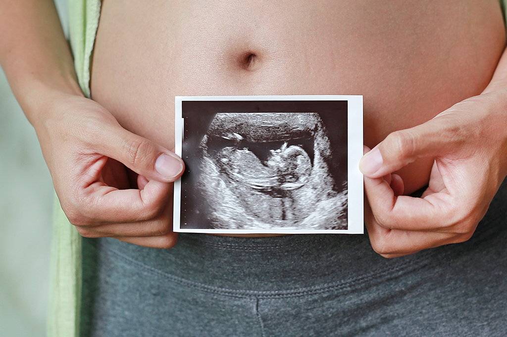 Terapia genética pode curar síndrome de Angelman em fetos