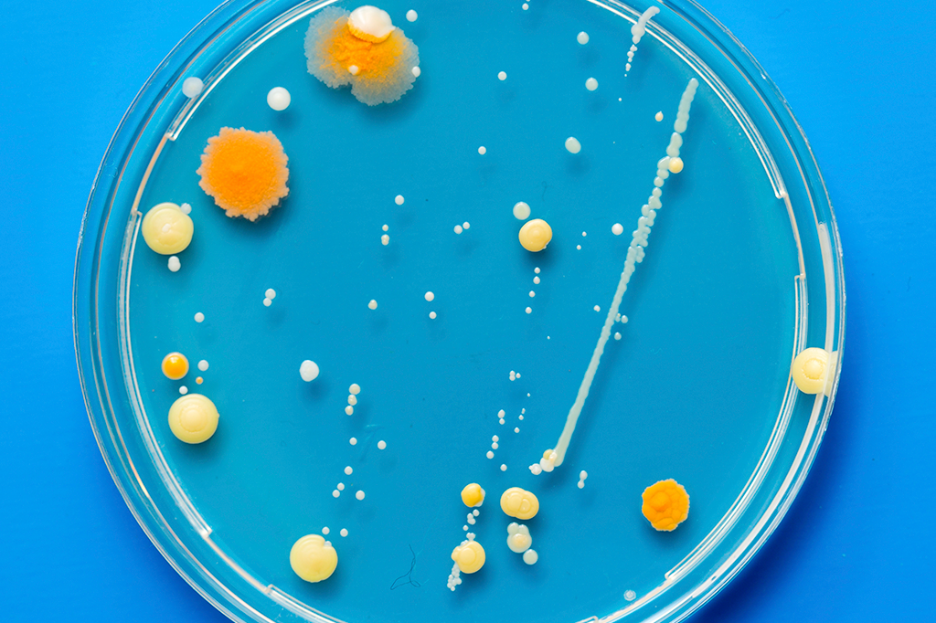 Mofos do lodo: eles não têm sistema nervoso – mas têm memória