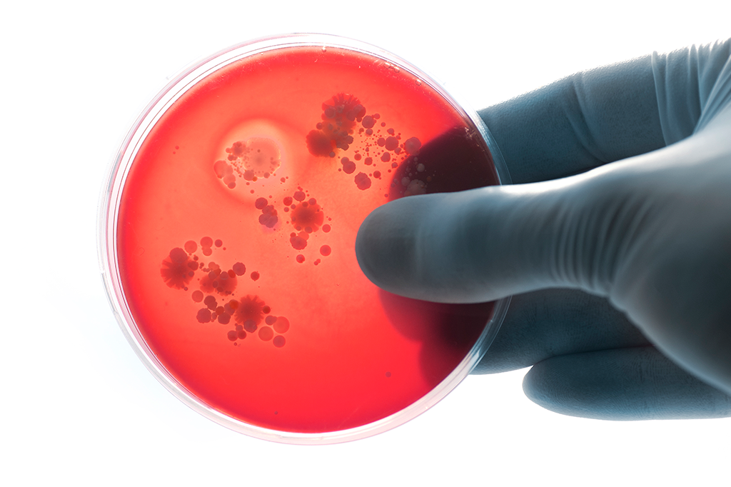 Cientistas descobrem composto que mata bactérias super-resistentes