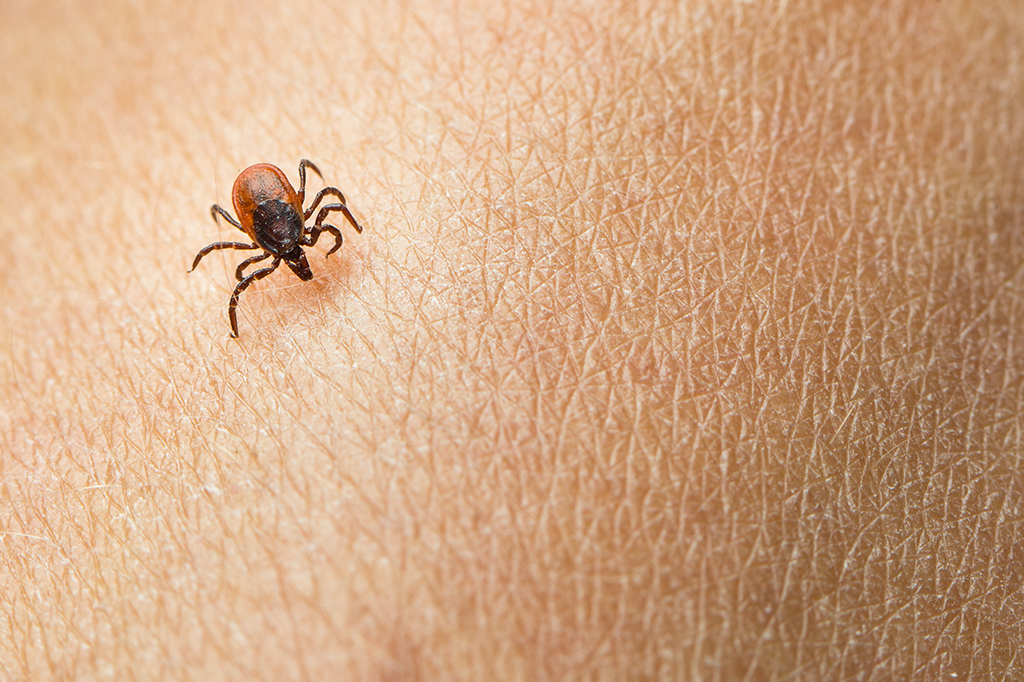 O jeito mais seguro de arrancar um carrapato da sua pele