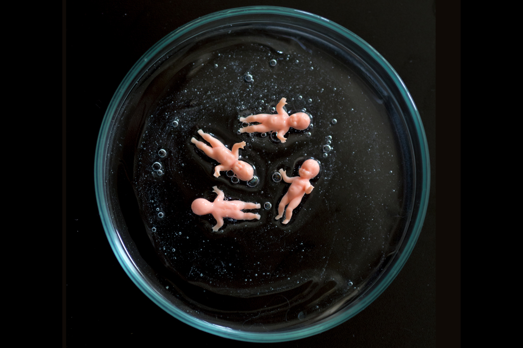 Nova técnica para separar esperma pode fazer menos garotas nascerem