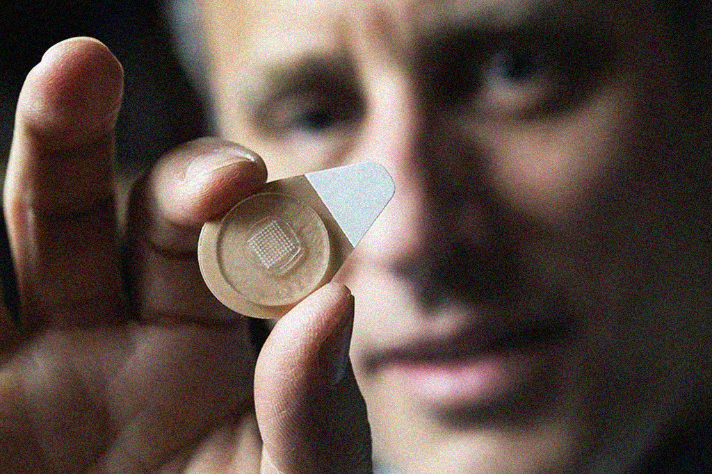 Entenda como funcionam os anticoncepcionais de microagulhas