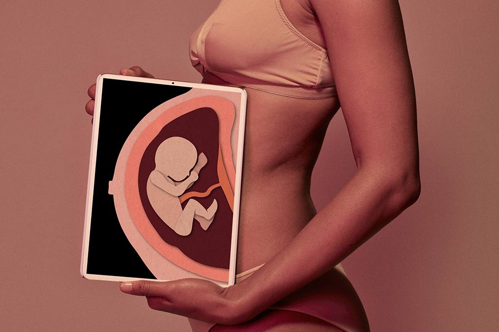 Clínicas estão oferecendo “reversão do aborto” nos EUA – e arriscando a vida de mulheres