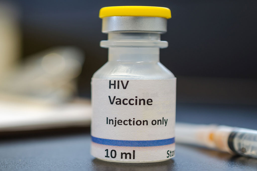 Teste promissor de vacina contra o HIV falha na África do Sul