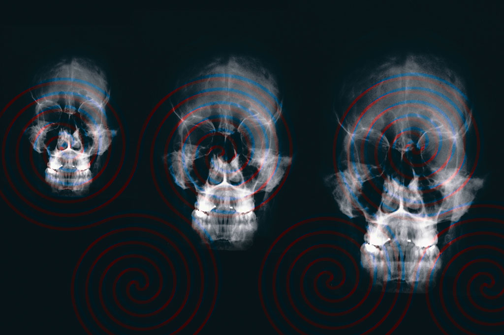 A hipnose realmente altera o funcionamento do cérebro?