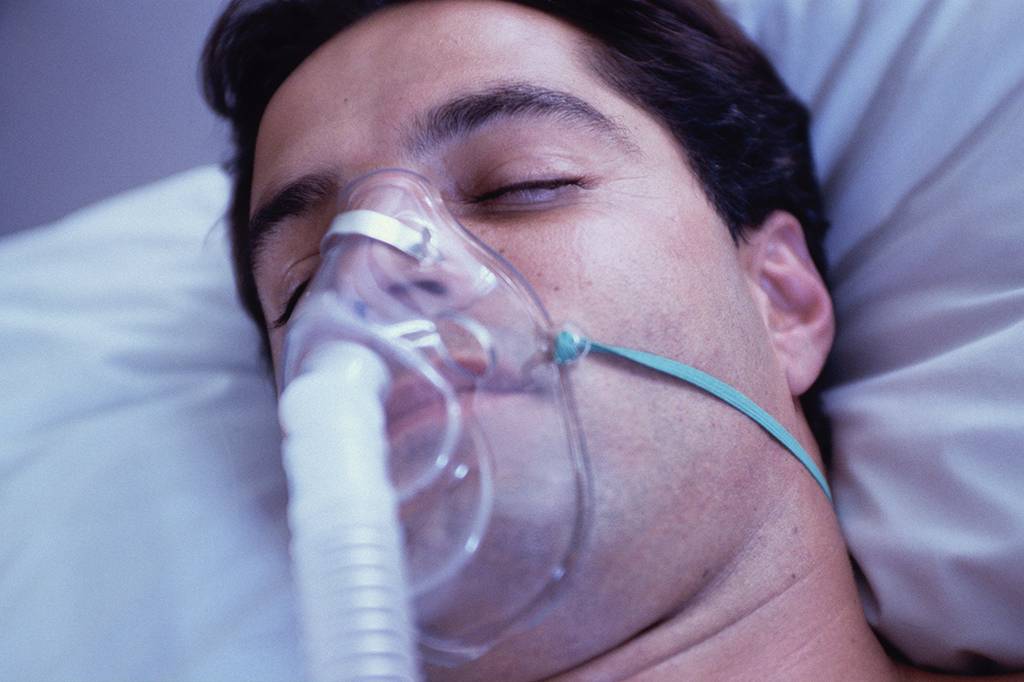 Casos de síndrome respiratória aguda grave avançam no Brasil