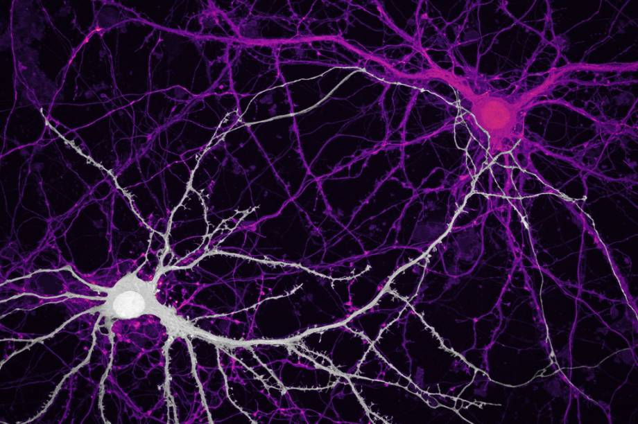 9º lugar: As conexões entre neurônios do hipocampo, região do cérebro humano ligada às emoções e à memória.