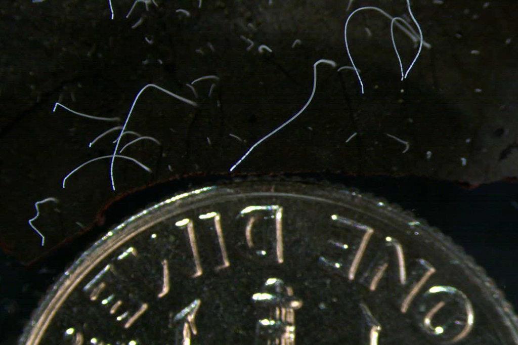 Os 3 problemas que impedem a existência de bactérias gigantes – e como essa bactéria de 1 cm evita todos eles