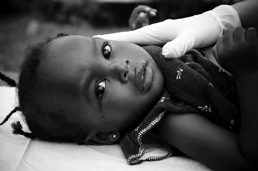 Racismo e xenofobia são ameaça à saúde de milhões em todo o mundo