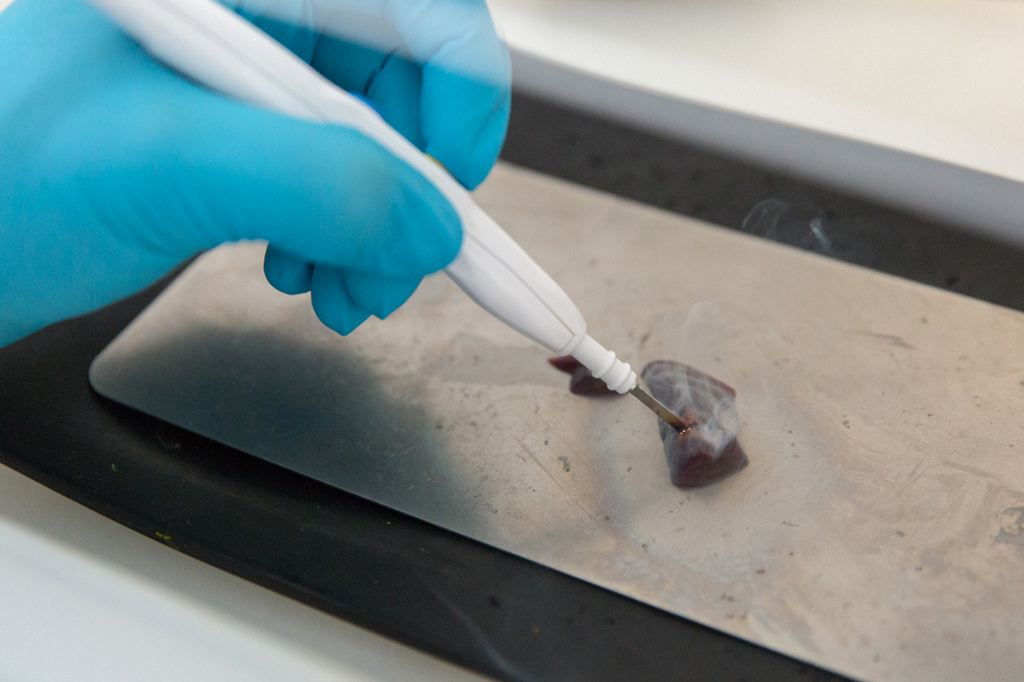 Faca cirúrgica que “cheira” tumores identifica câncer de útero em segundos