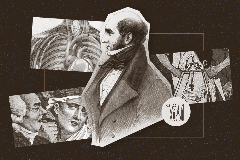 Colagem com retrato de Robert Liston e pinturas anatômicas e que retratam procedimentos cirúrgicos antigos.
