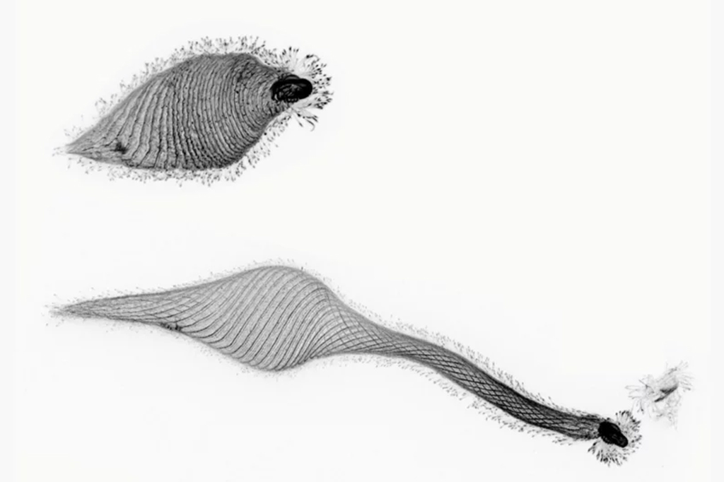 Uma comparação lado a lado do Lacrymaria olor, um notável ciliado com seu “pescoço” estendido e retraído.