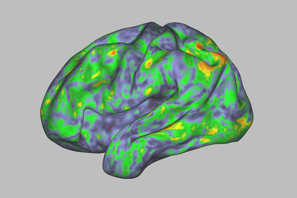 Veja como é um cérebro sob o efeito dos “cogumelos mágicos”