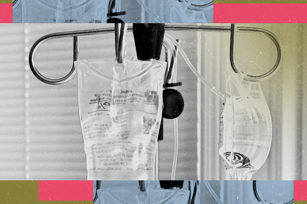 Imunoterapia pode causar câncer secundário, diz EMA