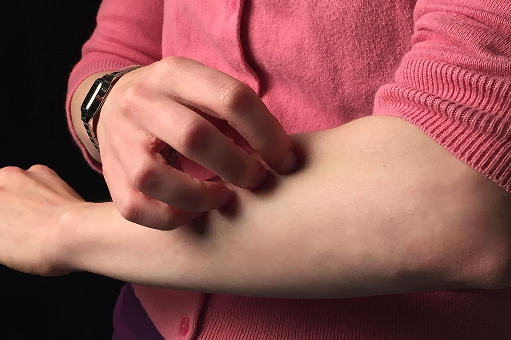 Coçar a pele irritada pode ser bom e ruim ao mesmo tempo