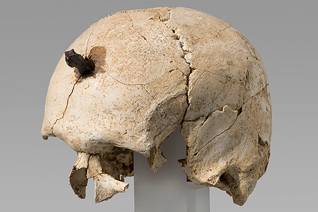 O mistério dos crânios perfurados com pregos na Idade do Bronze