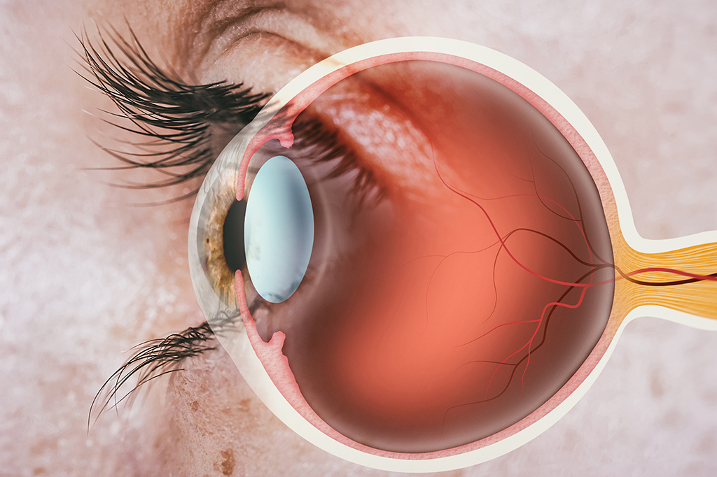 Imagem ilustrando a cornea do olho.