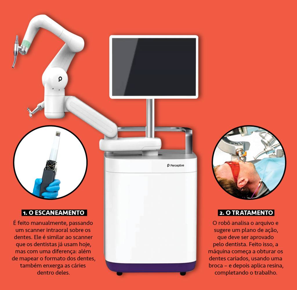 SI_473_Tech_Robô_Dentista_1 Infográfico, em fundo laranja, do funcionamento de um robô dentista.