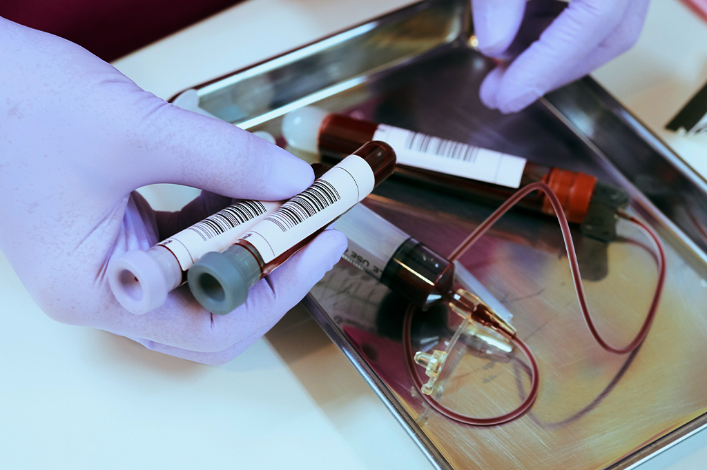 Imunoterapia pode ser caminho promissor para a cura do HIV, aponta estudo