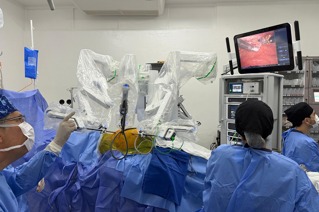 Fotografia de Médicos realizando uma revascularização do miocárdio (ponte de safena), utilizando tecnologia robótica